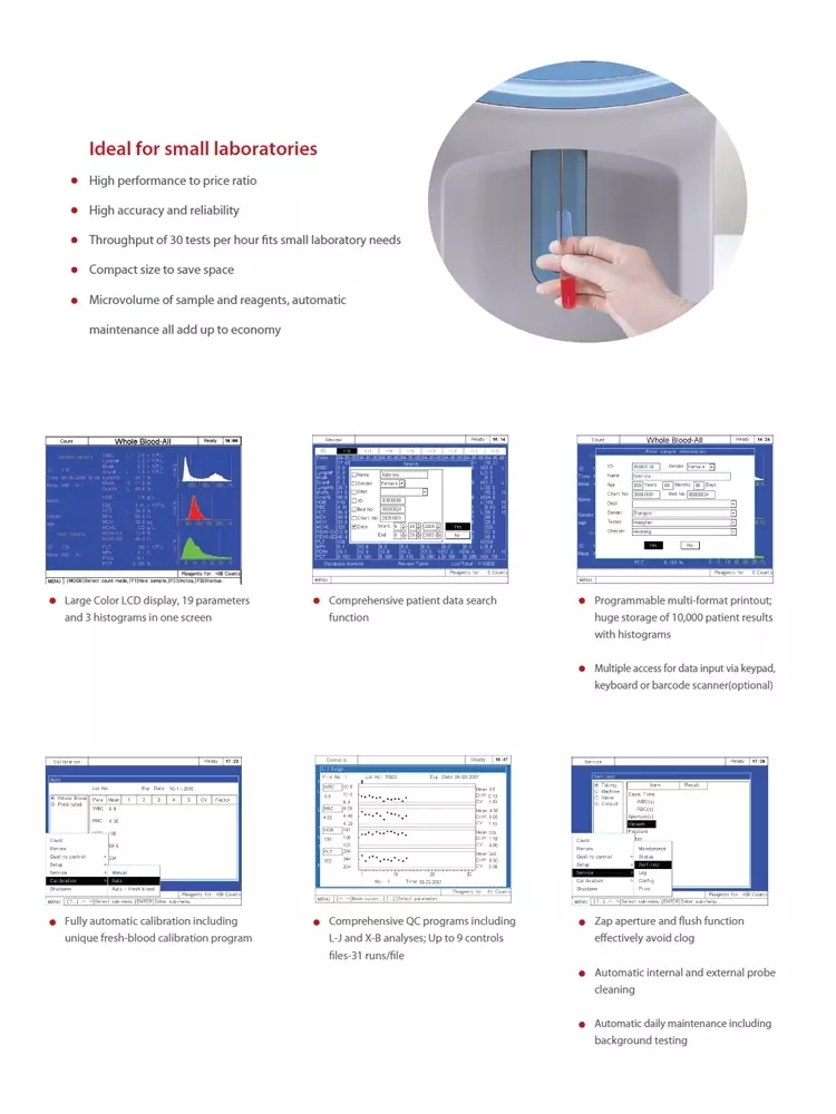 Hematology Analyser Machine Hematology Analyser Machine