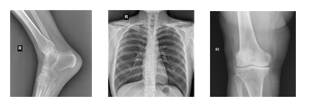Analogue High frequency X-ray Machine Analogue High frequency X-ray Machine
