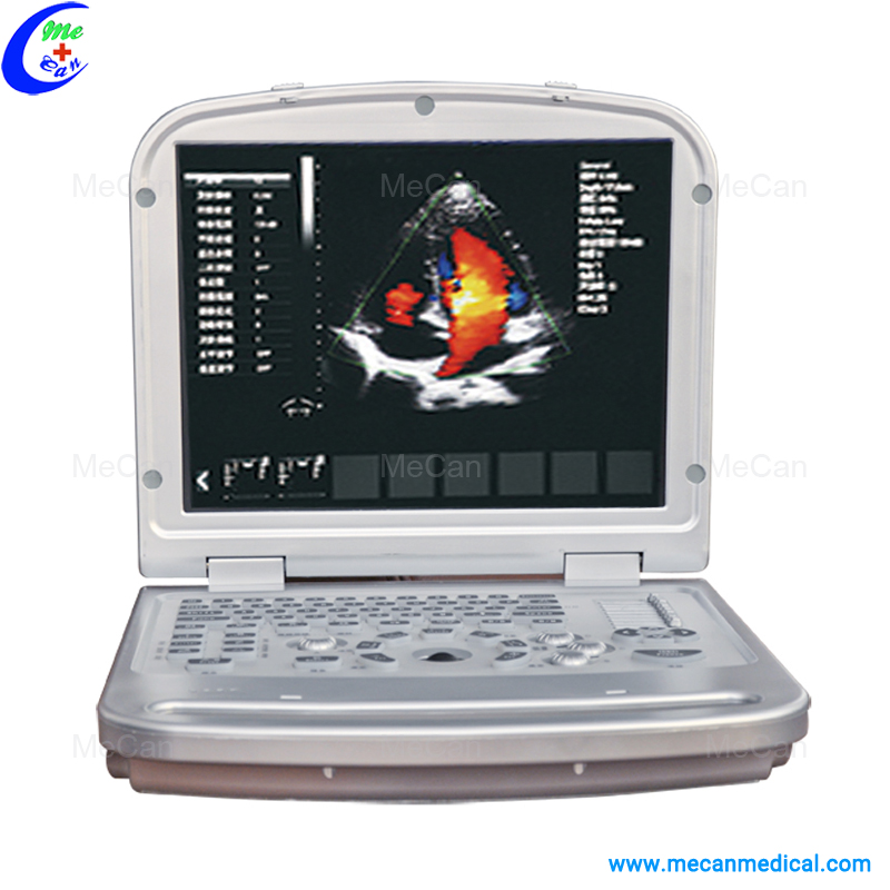 Laptop Color Doppler Laptop Color Doppler