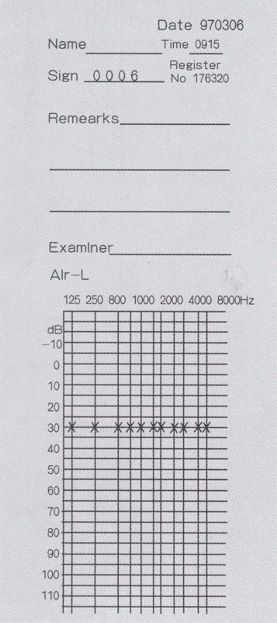 Diagnostic Audiometer