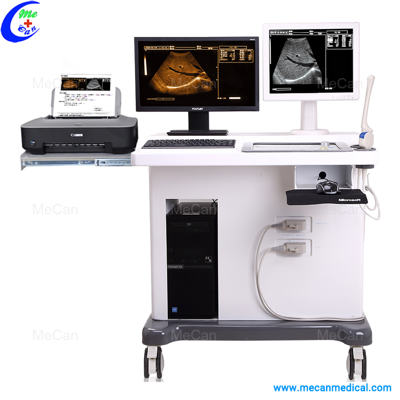 Trolley Ultrasound Scanner with Workstation Trolley Ultrasound Scanner with Workstation