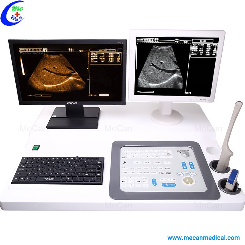 Trolley Ultrasound Scanner with Workstation Trolley Ultrasound Scanner with Workstation