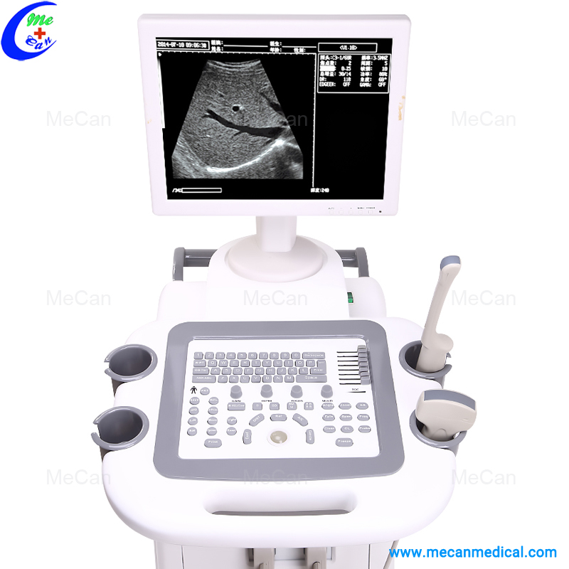Full Digital Trolley Ultrasound Scanner Full Digital Trolley Ultrasound Scanner