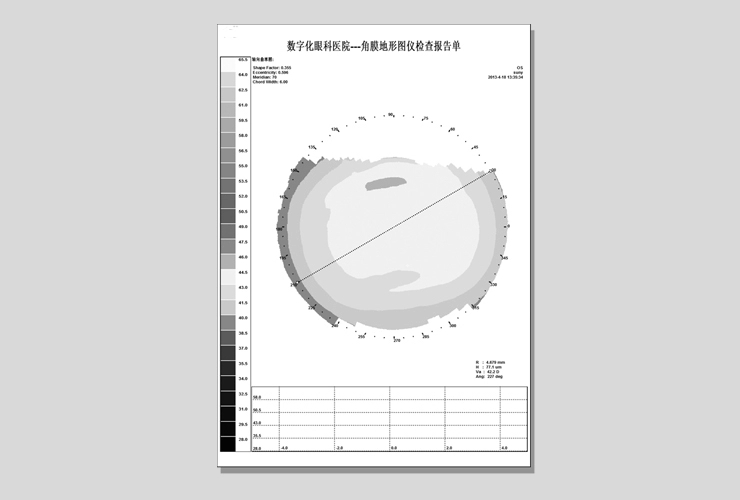 Eye Test Corneal Topographer Eye Test Corneal Topographer