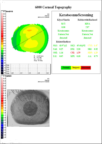 Eye Test Corneal Topographer Eye Test Corneal Topographer