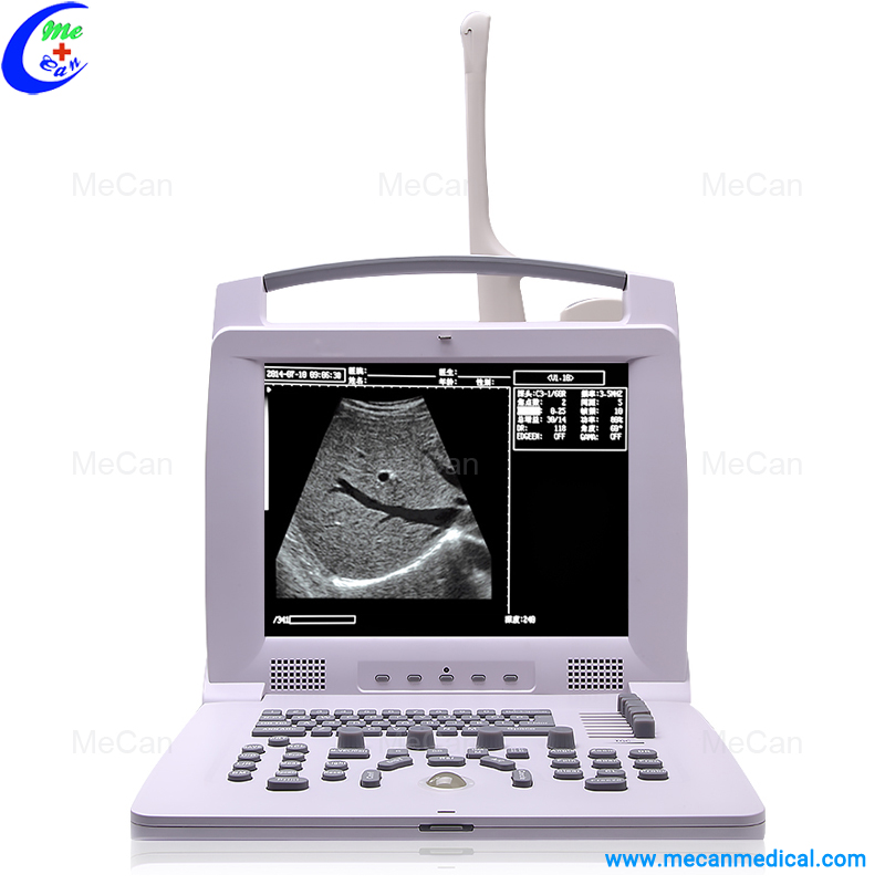 Full Digital Portable Ultrasound Scanner Full Digital Portable Ultrasound Scanner