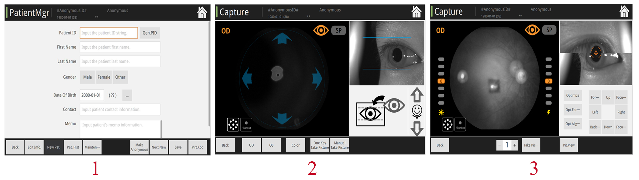 fundus camera fundus camera