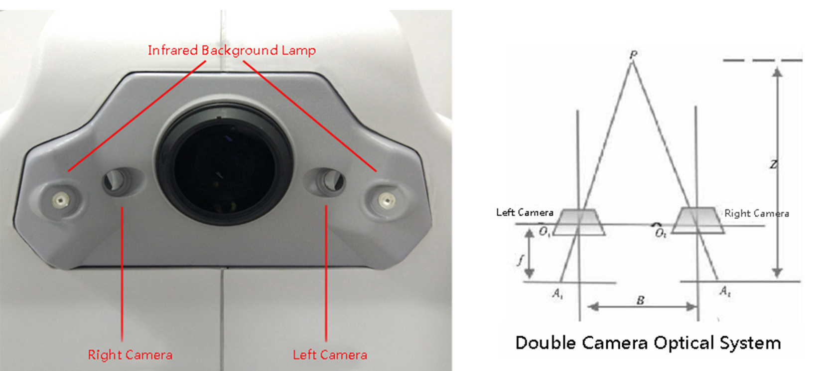 eye fundus camera eye fundus camera