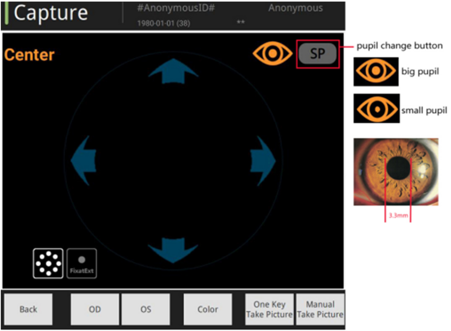 non-mydriatic fundus camera non-mydriatic fundus camera