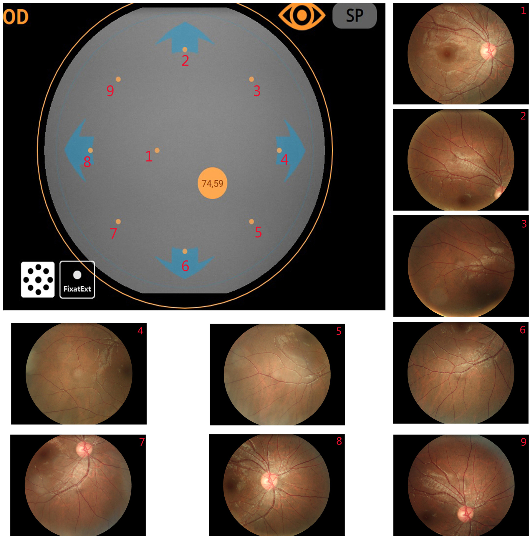 ophthalmic fundus camera ophthalmic fundus camera