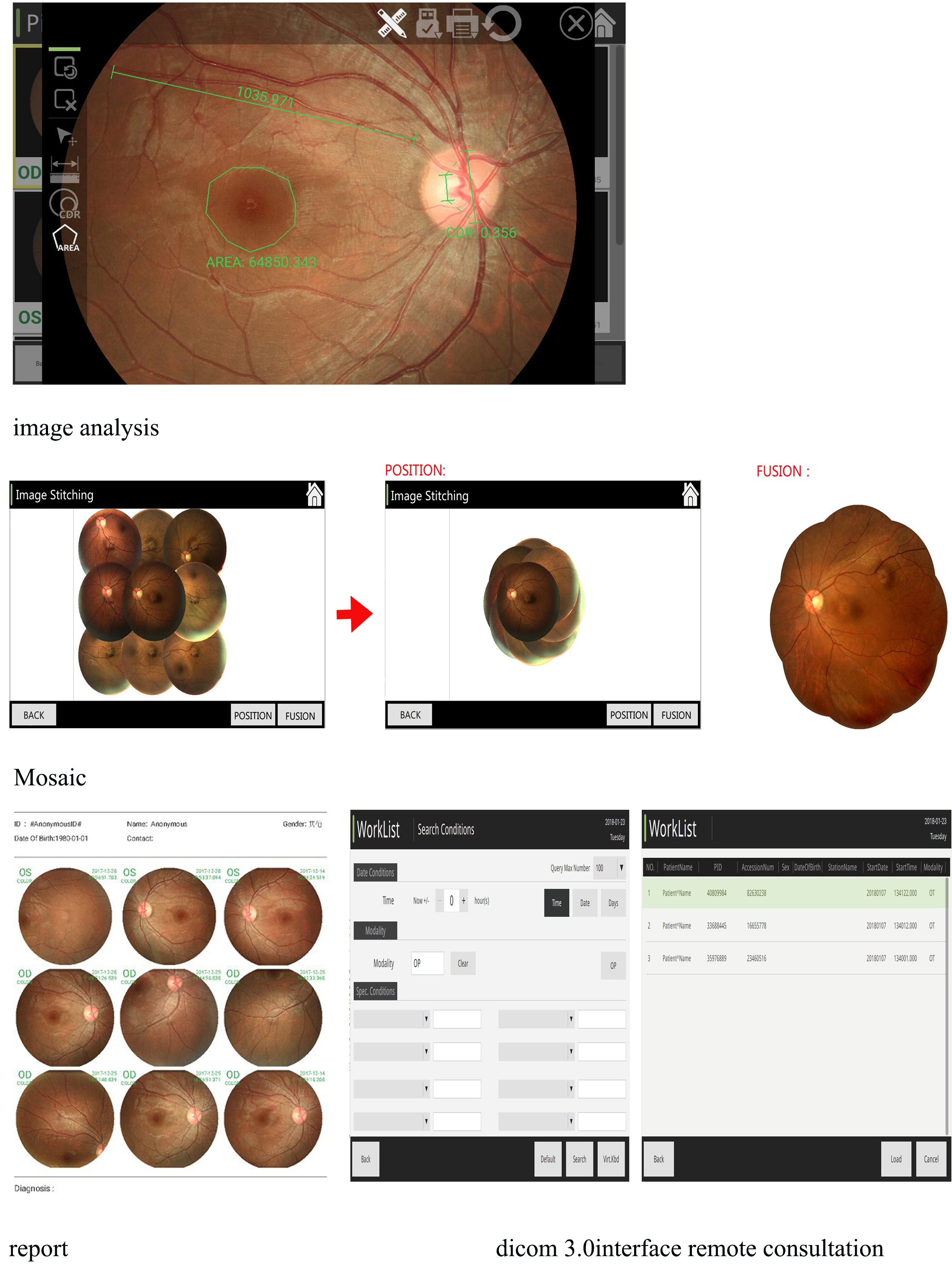 auto fundus camera auto fundus camera
