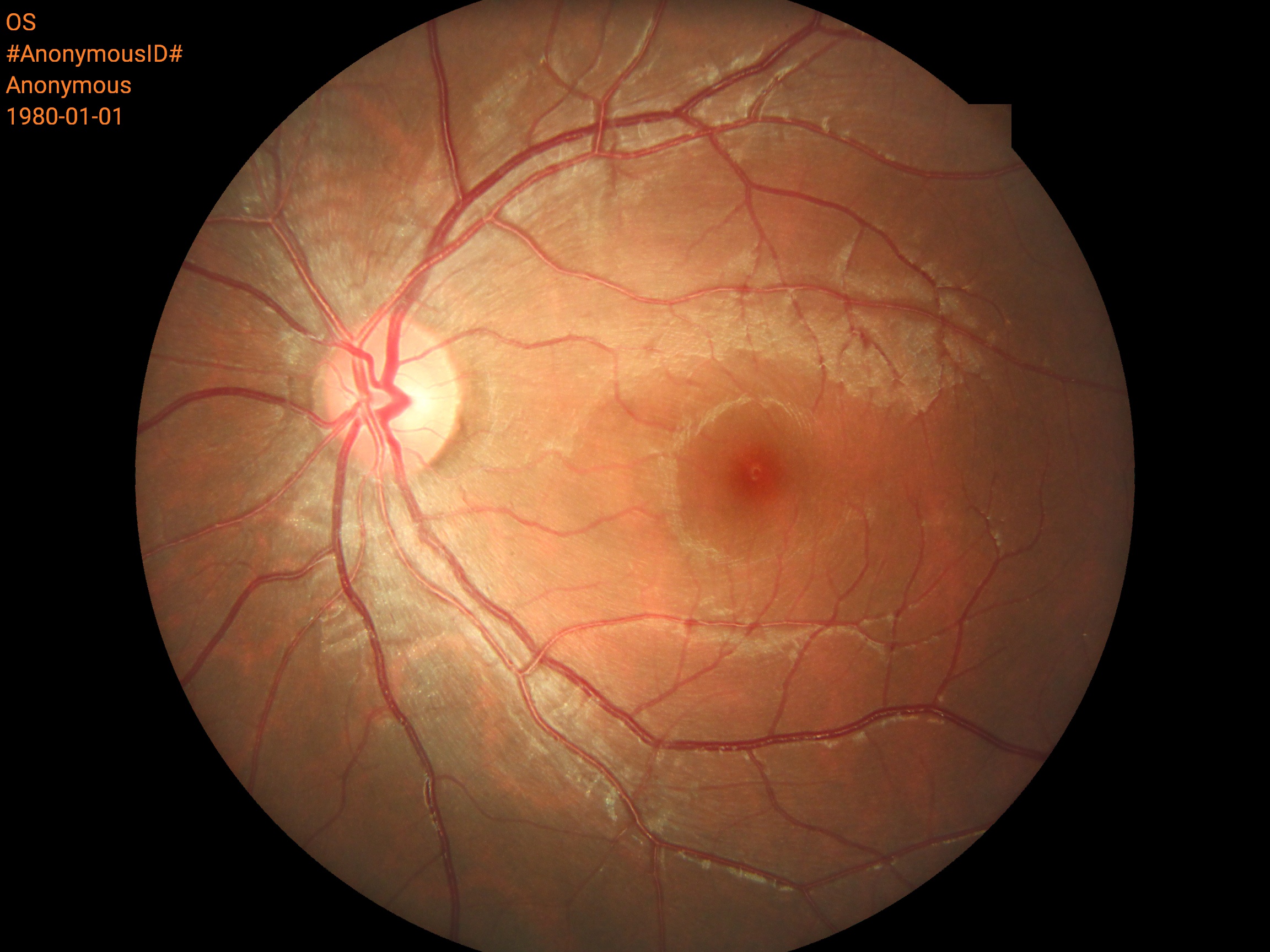 Ophthalmic Auto Digital Non-mydriatic Eye Fundus Camera With FFA Ophthalmic Auto Digital Non-mydriatic Eye Fundus Camera With FFA