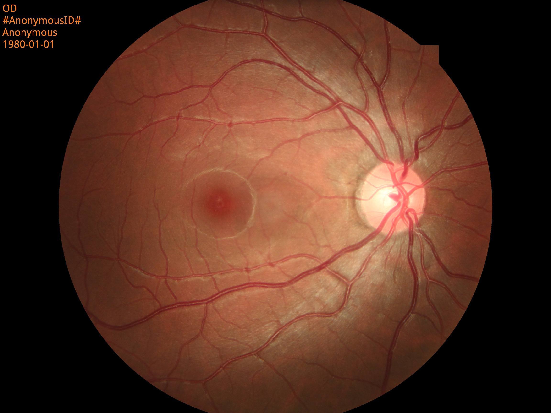 Ophthalmic Auto Digital Non-mydriatic Eye Fundus Camera With FFA Ophthalmic Auto Digital Non-mydriatic Eye Fundus Camera With FFA