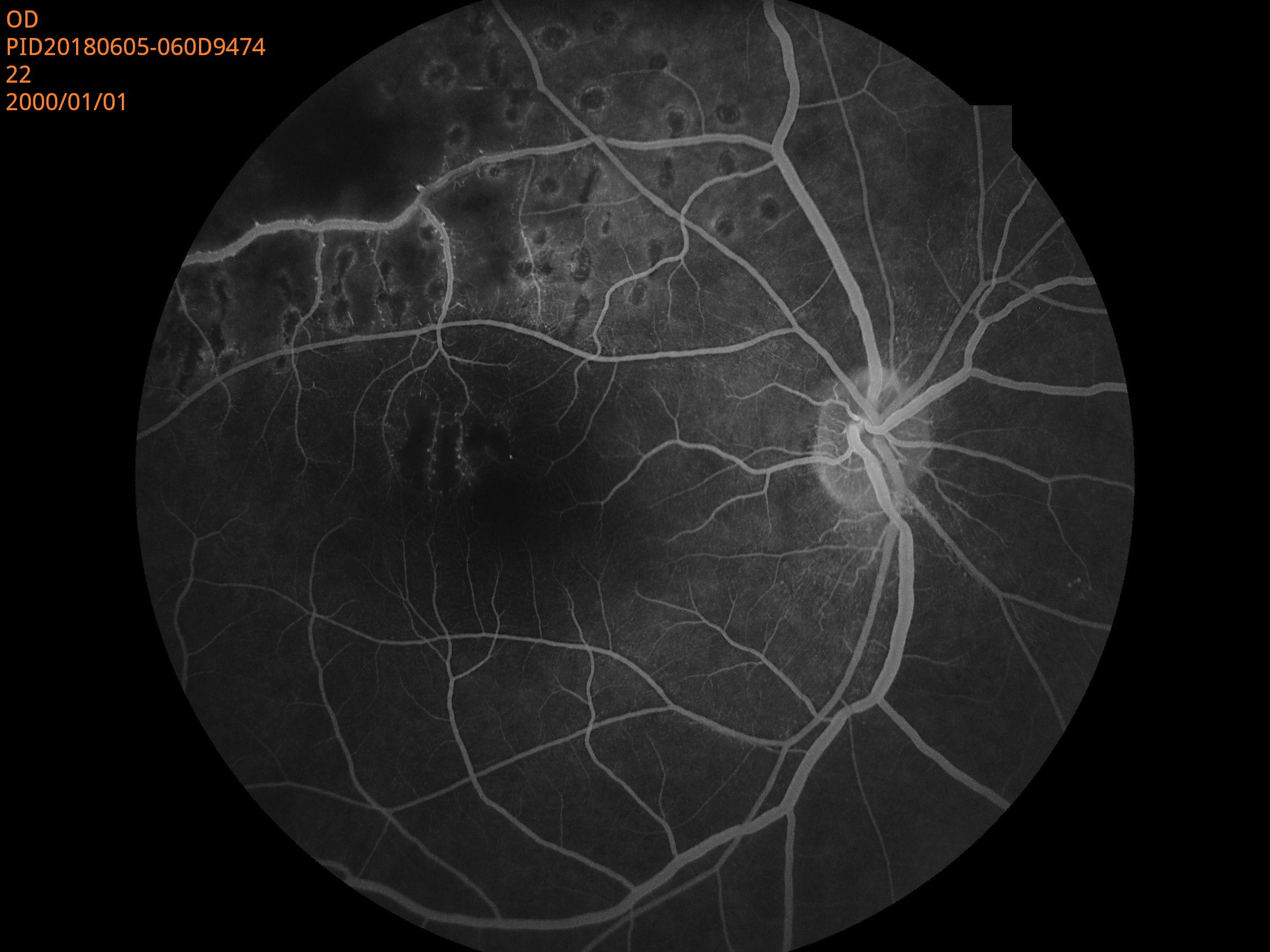 Ophthalmic Auto Digital Non-mydriatic Eye Fundus Camera With FFA Ophthalmic Auto Digital Non-mydriatic Eye Fundus Camera With FFA