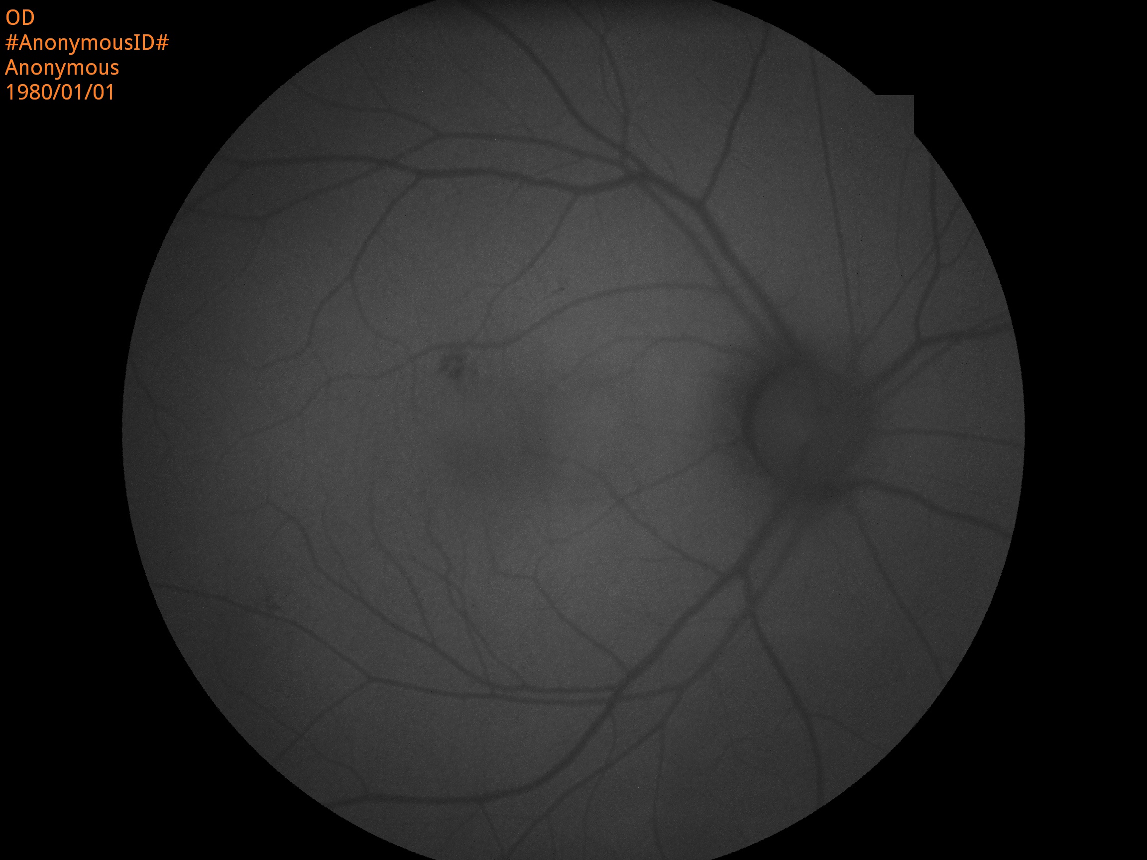 Ophthalmic Auto Digital Non-mydriatic Eye Fundus Camera With FFA Ophthalmic Auto Digital Non-mydriatic Eye Fundus Camera With FFA