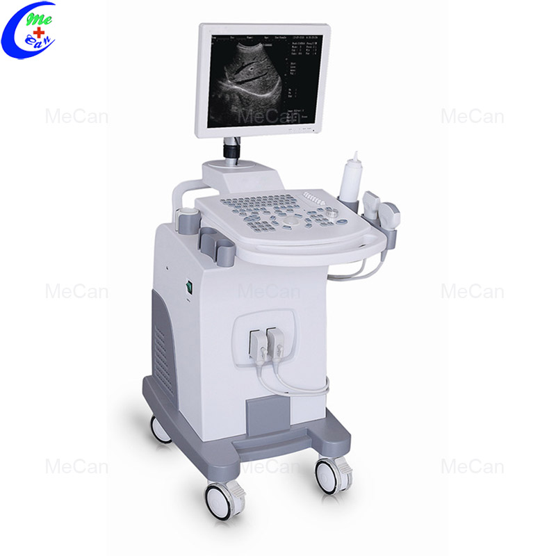 15 Inch 3 Probe Full-Digital Trolley Ultrasound Scanner 6