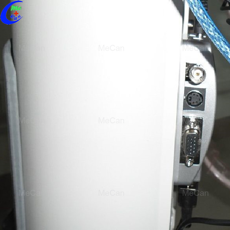 Touch Screen Trolley Ultrasound Diagnosis Black & White Scanner 8