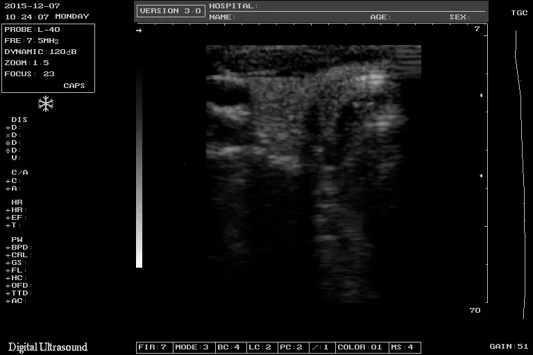 Notebook B/W Ultrasound Machine Notebook B/W Ultrasound Machine
