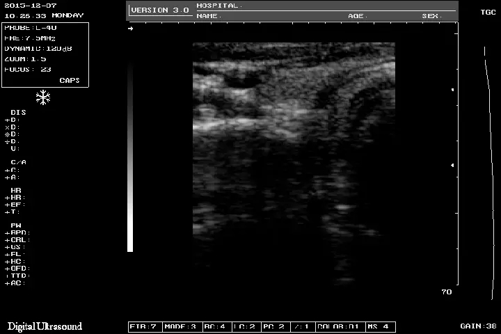 Notebook B/W Ultrasound Machine Notebook B/W Ultrasound Machine
