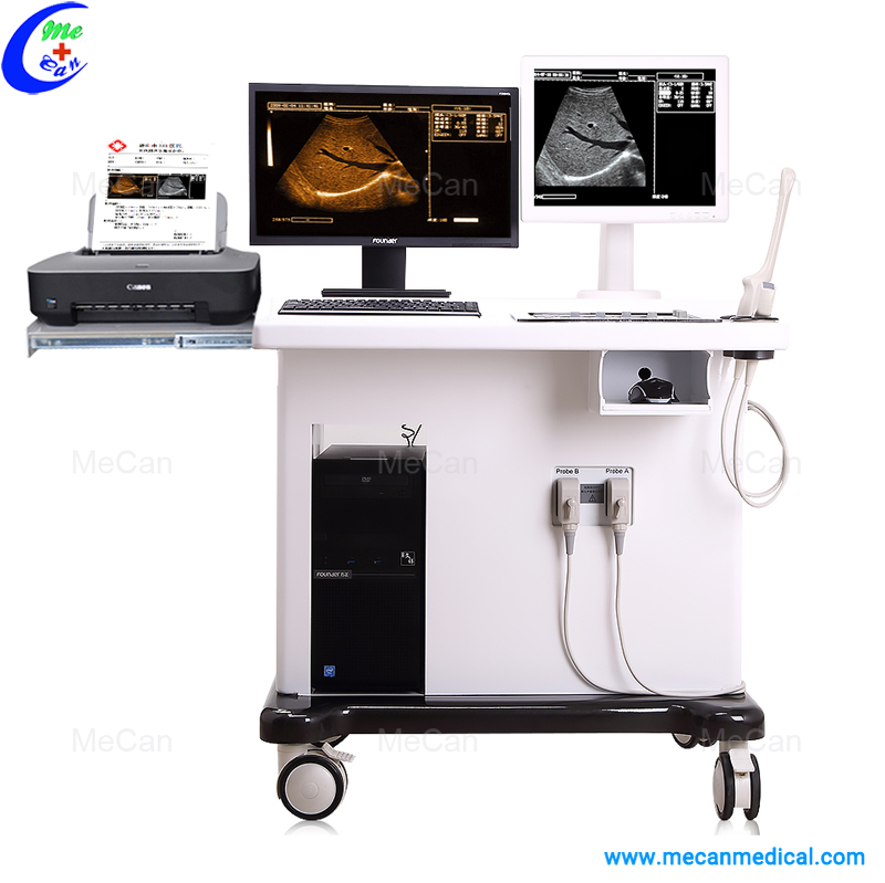Digital Trolley Ultrasound Scanner with Workstation Digital Trolley Ultrasound Scanner with Workstation