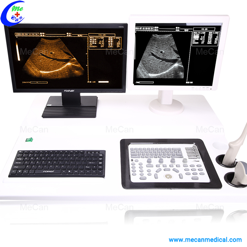 Digital Trolley Ultrasound Scanner with Workstation Digital Trolley Ultrasound Scanner with Workstation