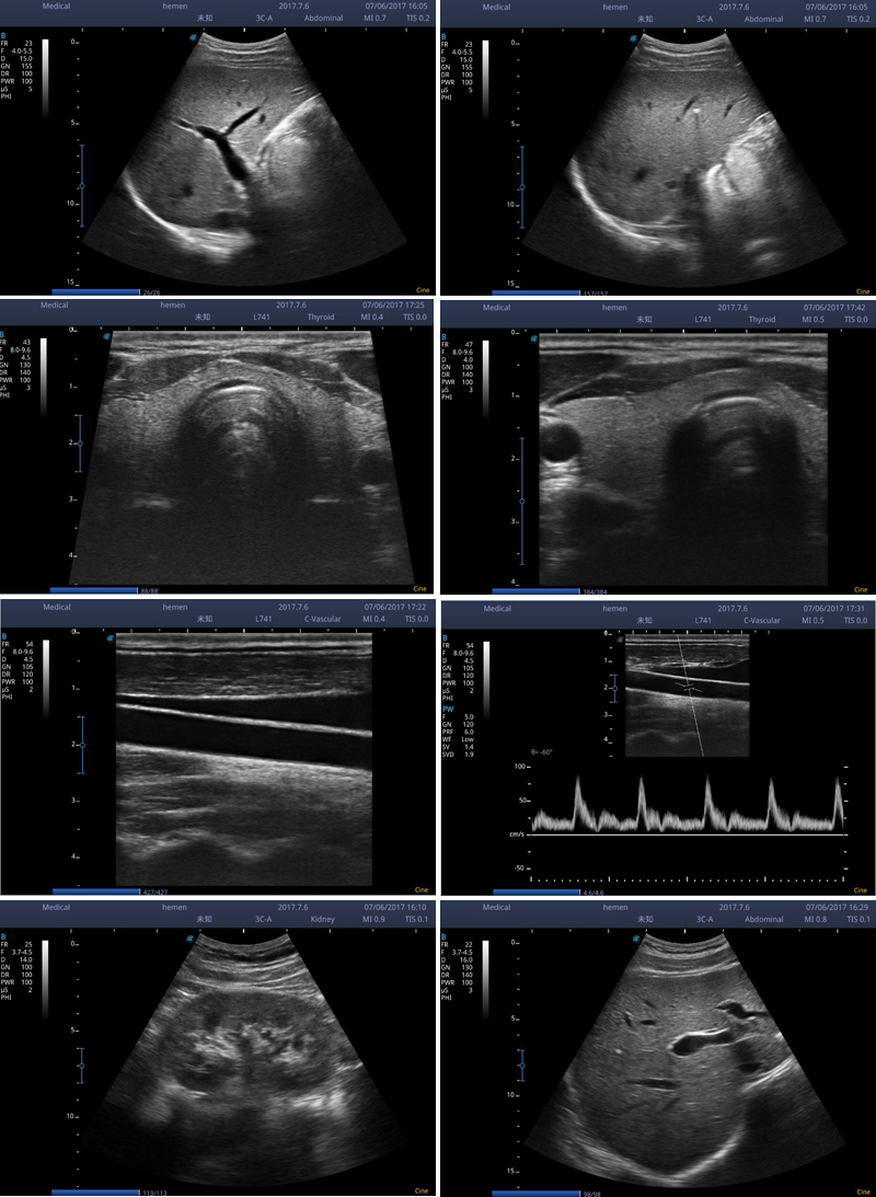 msk ultrasound scan msk ultrasound scan