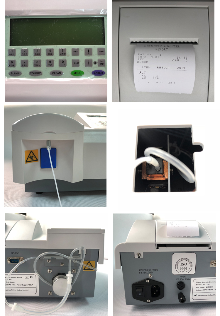 chemistry analyzer