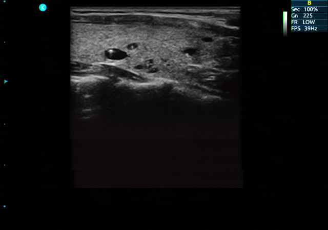 Ultrasound Scanner Ultrasound Scanner