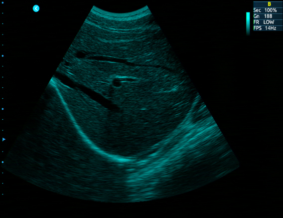 Ultrasound Scanner Ultrasound Scanner