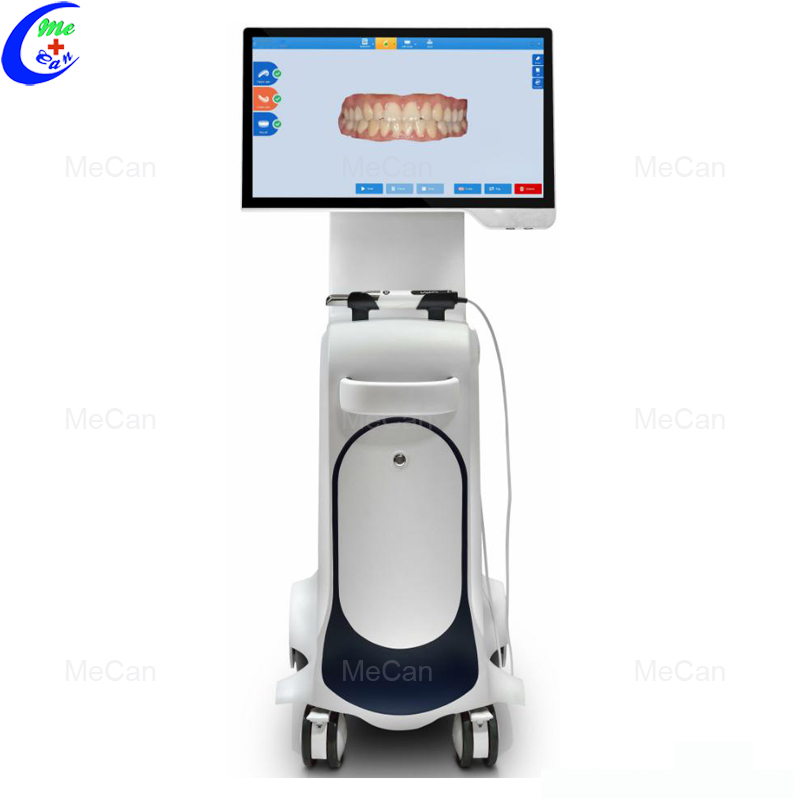 3D Intraoral Scanner 3D Intraoral Scanner