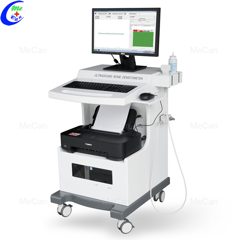 Automatic High Effective Trolley Ultrasound Bone Densitometer 3