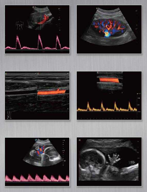 Sonoscape S22 Portable Cardiovascular Ultrasound Machine With Elastography 10
