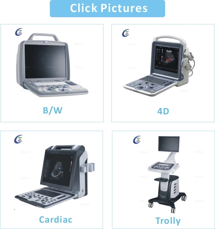 Portable Color Doppler Musculoskeletal Ultrasound Machine 6