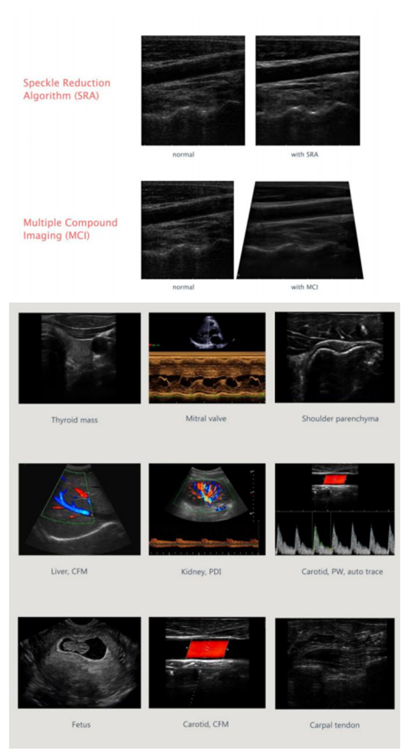 Good Price Portable Cardiac Ultrasound Machine 4