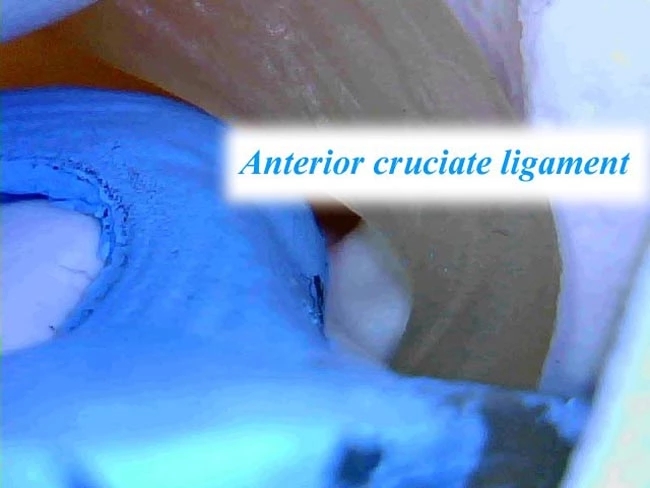 Arthroscopic Knee Simuator Model Sets Arthroscopic Knee Simuator Model Sets