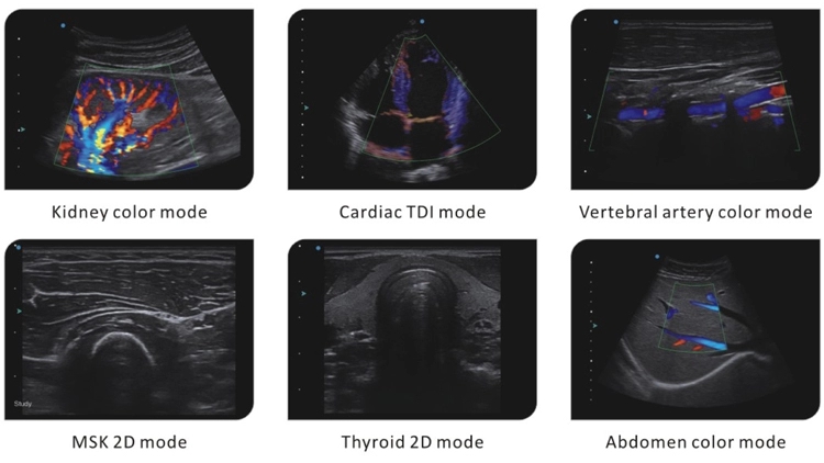 Cardiac 2D 3D Portable Echocardiography Machine Ultrasound 7