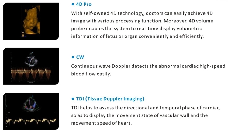 Cardiac 2D 3D Portable Echocardiography Machine Ultrasound 8