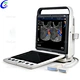 Sonoscape Portable Cardiovascular Ultrasound Machine