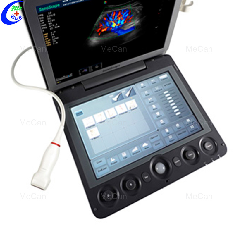 Sonoscape Portable Cardiovascular Ultrasound Machine 7