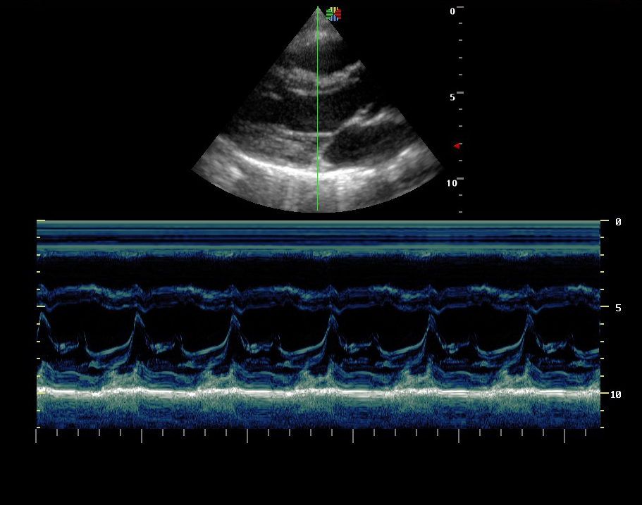 Sonoscape Portable Cardiovascular Ultrasound Machine 8