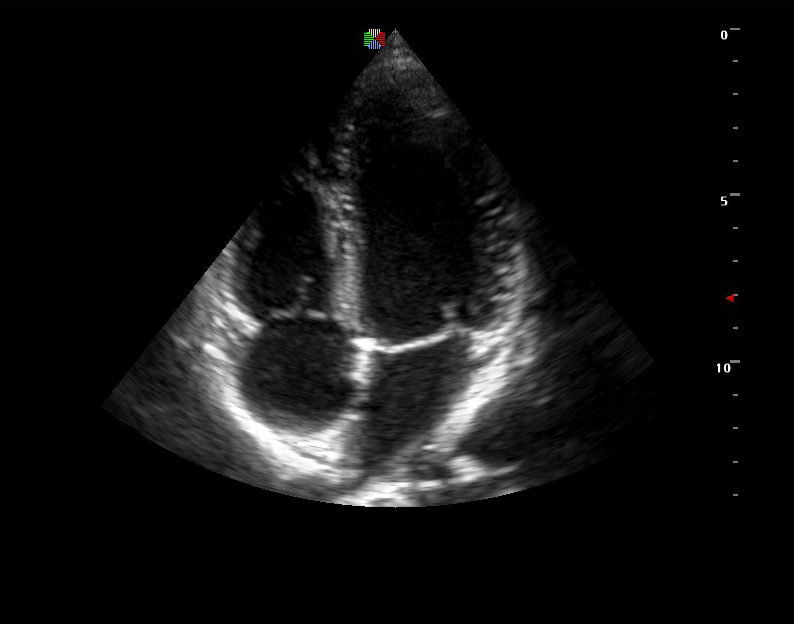 Sonoscape Portable Cardiovascular Ultrasound Machine 9