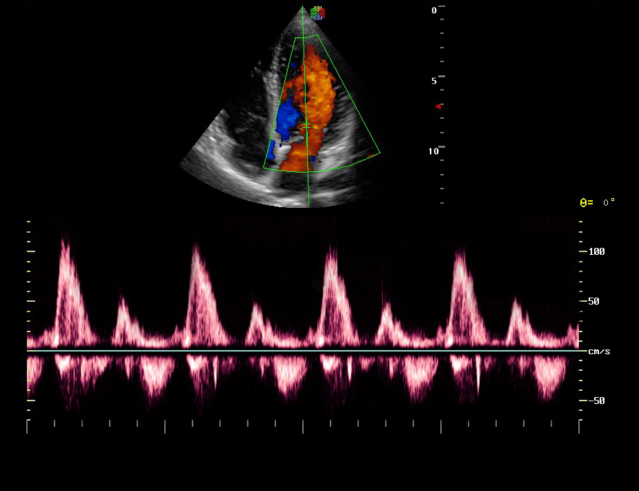 Sonoscape Portable Cardiovascular Ultrasound Machine 12