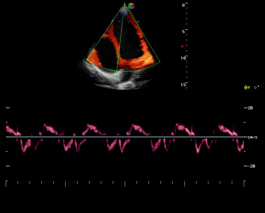 Sonoscape Portable Cardiovascular Ultrasound Machine 13