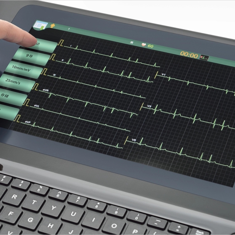 12-channel ECG-1212 electrocardiograph portable ECG machine 3
