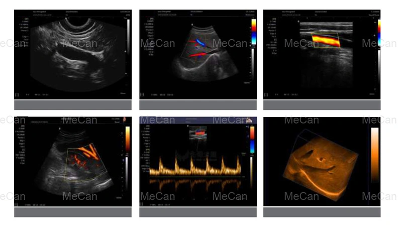 Portable full digital color Doppler ultrasound diagnostic Machine ...