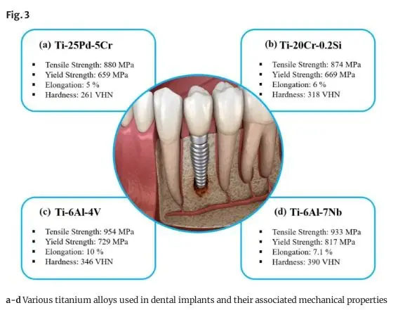 Various titanium alloys used in dental implants and their related mechanical properties.
