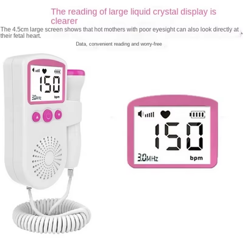 Fetal doppler real Pictures