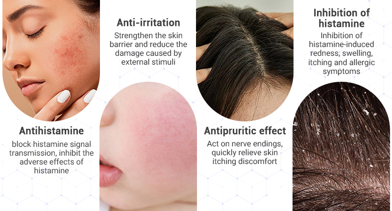 Hydroxyphenyl Propamidobenzoic Acid ,propamidobenzoic acid,hydroxyphenyl propamidobenzoic acid in skin care