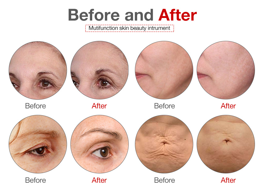 before & treatment.jpg