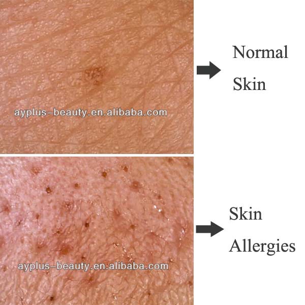 Skin.jpg